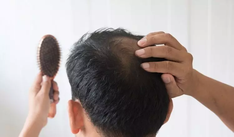 Health: మగవారికి గుడ్ న్యూస్.. జుట్టు సమస్యలకు అదిరే చిట్కాలు ఇవే.. Health: మగవారికి గుడ్ న్యూస్.. జుట్టు సమస్యలకు అదిరే చిట్కాలు ఇవే..