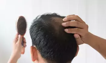 Health: మగవారికి గుడ్ న్యూస్.. జుట్టు సమస్యలకు అదిరే చిట్కాలు ఇవే.. Health: మగవారికి గుడ్ న్యూస్.. జుట్టు సమస్యలకు అదిరే చిట్కాలు ఇవే..
