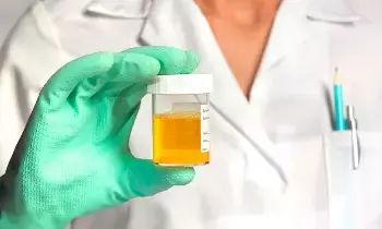 Kidneys: మూత్ర పోసేటప్పుడు నురుగు వస్తుందా? అయితే ఈ వ్యాధి.. Kidneys: మూత్ర పోసేటప్పుడు నురుగు వస్తుందా? అయితే ఈ వ్యాధి..