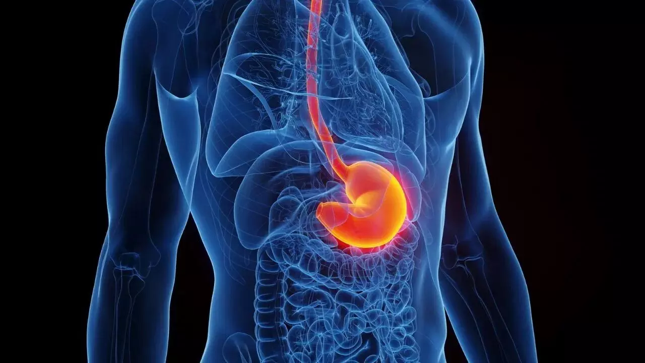 Acidity and Heartburn: ఎసిడిటీ - గుండెల్లో మంట సమస్యలను ఇలా తగ్గించుకోండి..? Acidity and Heartburn: ఎసిడిటీ - గుండెల్లో మంట సమస్యలను ఇలా తగ్గించుకోండి..?