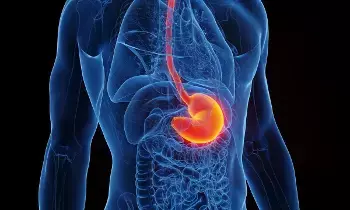 Acidity and Heartburn: ఎసిడిటీ - గుండెల్లో మంట సమస్యలను ఇలా తగ్గించుకోండి..? Acidity and Heartburn: ఎసిడిటీ - గుండెల్లో మంట సమస్యలను ఇలా తగ్గించుకోండి..?
