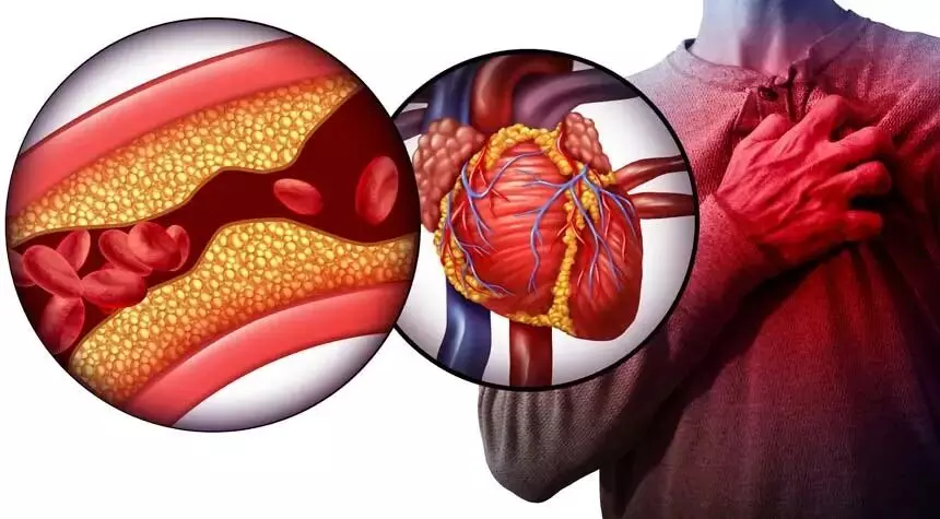 Heart Attack Alert: అలర్ట్: చిన్న సమస్యే కదా అని నిర్లక్ష్యం చేస్తున్నారా.? Heart Attack Alert: అలర్ట్: చిన్న సమస్యే కదా అని నిర్లక్ష్యం చేస్తున్నారా.?