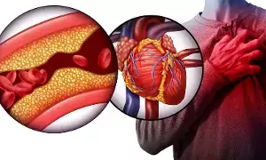 Heart Attack Alert: అలర్ట్: చిన్న సమస్యే కదా అని నిర్లక్ష్యం చేస్తున్నారా.? Heart Attack Alert: అలర్ట్: చిన్న సమస్యే కదా అని నిర్లక్ష్యం చేస్తున్నారా.?
