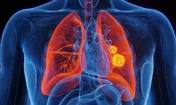 Damage Your Lungs: ధూమపానం మాత్రమే కాదు.. ఊపిరితిత్తులను దెబ్బతీసేవి ఇవే. Damage Your Lungs: ధూమపానం మాత్రమే కాదు.. ఊపిరితిత్తులను దెబ్బతీసేవి ఇవే.