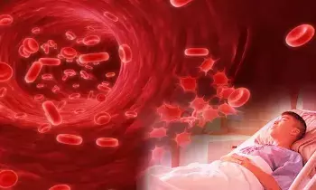 Platelets: ప్లేట్ లెట్స్ అంటే ఏంటి..ఎందుకు తగ్గుతాయి? Platelets: ప్లేట్ లెట్స్ అంటే ఏంటి..ఎందుకు తగ్గుతాయి?