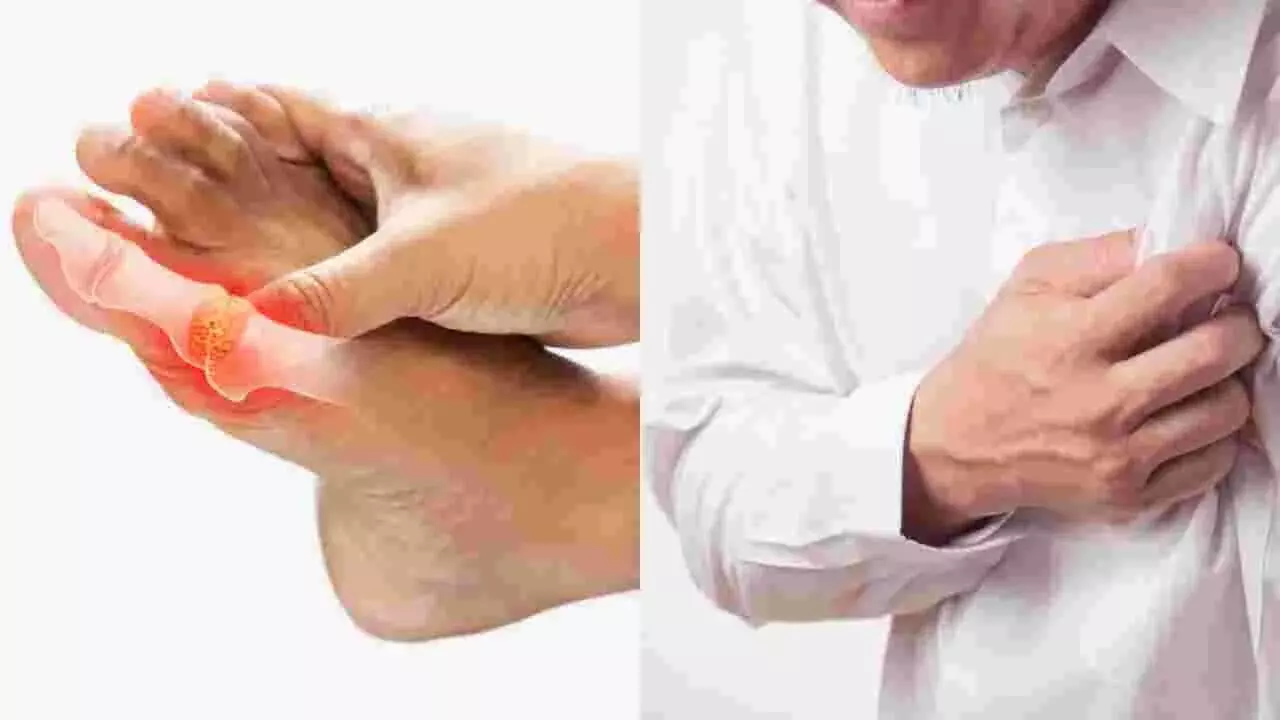 Uric Acid: యూరిక్ ఆసిడ్ ను లైట్ తీసుకోవద్దు.? జాగ్రత్త Uric Acid: యూరిక్ ఆసిడ్ ను లైట్ తీసుకోవద్దు.? జాగ్రత్త
