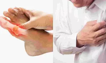 Uric Acid: యూరిక్ ఆసిడ్ ను లైట్ తీసుకోవద్దు.? జాగ్రత్త Uric Acid: యూరిక్ ఆసిడ్ ను లైట్ తీసుకోవద్దు.? జాగ్రత్త