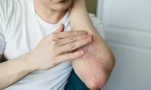 Skin Problems: వర్షాకాలంలో చర్మ సమస్యలు.. ఏం చేయాలంటే..? Skin Problems: వర్షాకాలంలో చర్మ సమస్యలు.. ఏం చేయాలంటే..?