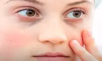 Dark Circles: ఇంటి చిట్కాలతో డార్క్ సర్కిల్స్కు చెక్! Dark Circles: ఇంటి చిట్కాలతో డార్క్ సర్కిల్స్కు చెక్!