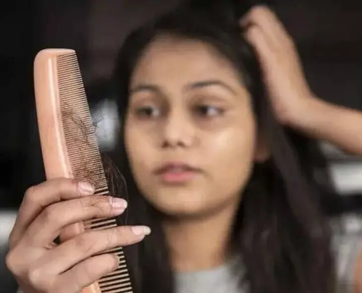 Excessive Hair Fall: జుట్టు విపరీతంగా రాలుతోందా? ఏం చేయాలంటే? Excessive Hair Fall: జుట్టు విపరీతంగా రాలుతోందా? ఏం చేయాలంటే?