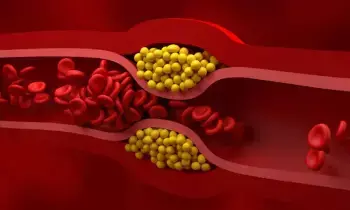 Reduce Your Bad Cholesterol in Just 3 Months: ఇవి తింటే 3 నెలల్లోనే మీ చెడు కొలెస్ట్రాల్ను తగ్గుతుంది.. Reduce Your Bad Cholesterol in Just 3 Months: ఇవి తింటే 3 నెలల్లోనే మీ చెడు కొలెస్ట్రాల్ను తగ్గుతుంది..
