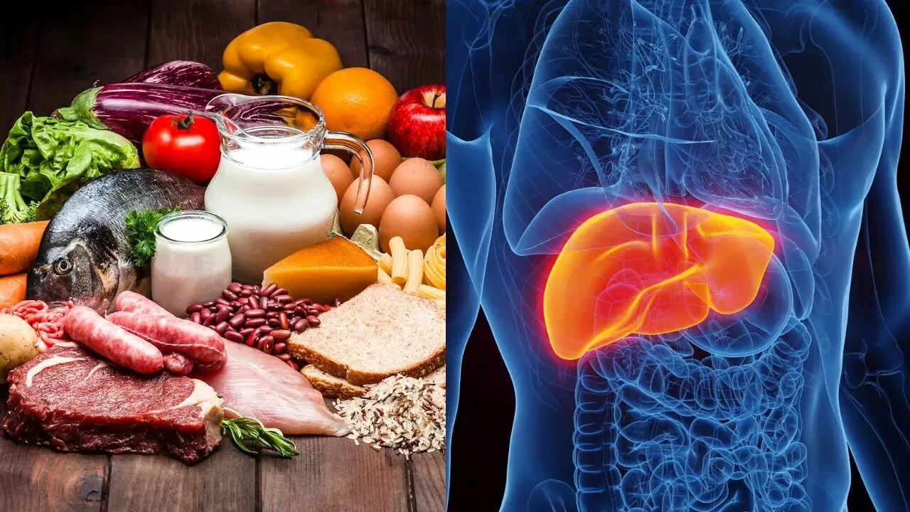 Fatty Liver: ఫ్యాటీ లివర్ ఉన్నవారు ఈ 5 ఫుడ్స్ అస్సలు తినొద్దు