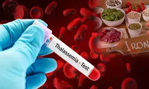 Thalassemia: తలసేమియా అంటే ఏంటీ..? ఈ వ్యాధి ఎలా వస్తుంది..?