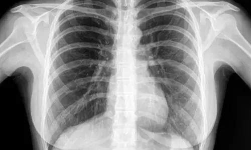 Getting a Chest X-Ray: చెస్ట్ ఎక్స్ రే తీయించుకుంటున్నారా? ఈ విషయం తెలుసుకోండి