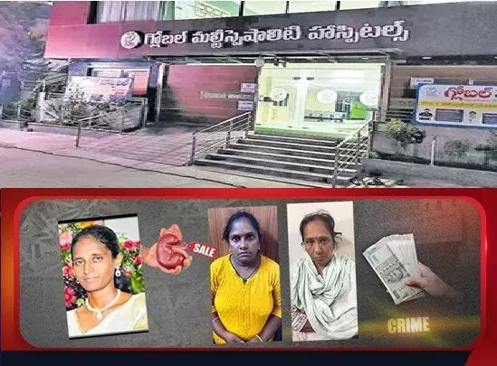Kidney Racket in Madanapalle:  మదనపల్లిలో కిడ్నీ రాకెట్: మహిళ మరణంతో బయటపడిన ముఖ్య గుట్టు