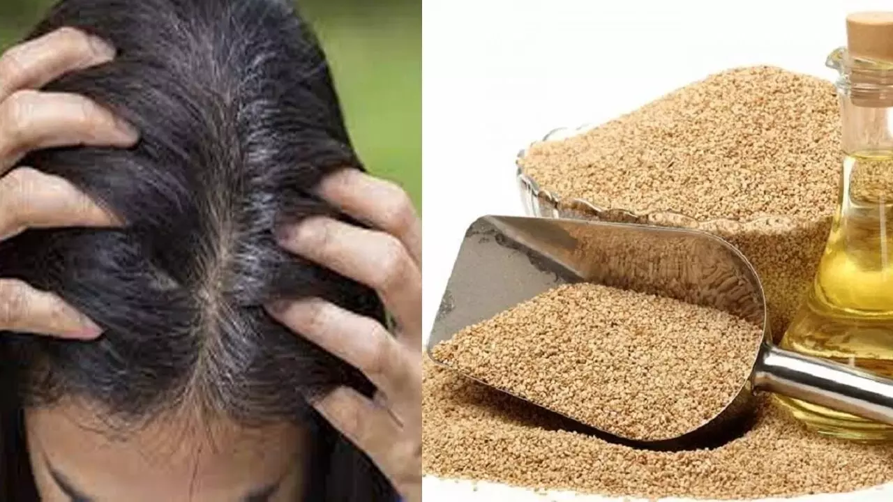 Sesame Oil: నువ్వుల నూనెతో జుట్టు సమస్యలు మాయం!