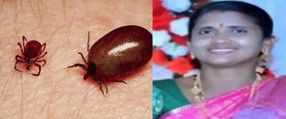 ఆంధ్రప్రదేశ్లో స్క్రబ్ టైఫస్ కలవరం.. చిత్తూరు, కాకినాడ, విశాఖ జిల్లాలు అత్యధికంగా బాధితం – ఇప్పటివరకు 1317 కేసులు నమోదు, ఒక మరణం ఆంధ్రప్రదేశ్లో స్క్రబ్ టైఫస్ కలవరం.. చిత్తూరు, కాకినాడ, విశాఖ జిల్లాలు అత్యధికంగా బాధితం – ఇప్పటివరకు 1317 కేసులు నమోదు, ఒక మరణం