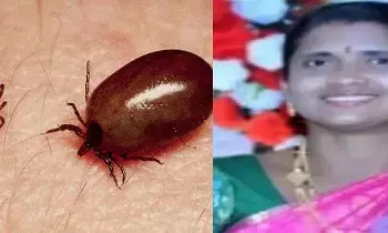 ఆంధ్రప్రదేశ్లో స్క్రబ్ టైఫస్ కలవరం.. చిత్తూరు, కాకినాడ, విశాఖ జిల్లాలు అత్యధికంగా బాధితం – ఇప్పటివరకు 1317 కేసులు నమోదు, ఒక మరణం ఆంధ్రప్రదేశ్లో స్క్రబ్ టైఫస్ కలవరం.. చిత్తూరు, కాకినాడ, విశాఖ జిల్లాలు అత్యధికంగా బాధితం – ఇప్పటివరకు 1317 కేసులు నమోదు, ఒక మరణం