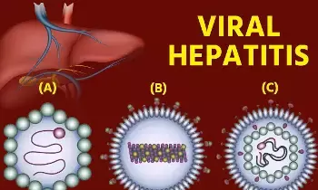 Hepatitis B Alert: హెపటైటిస్ బి హెచ్చరిక: వీటిని నిర్లక్ష్యం చేస్తే కాలేయం దెబ్బతినడం ఖాయం.. Hepatitis B Alert: హెపటైటిస్ బి హెచ్చరిక: వీటిని నిర్లక్ష్యం చేస్తే కాలేయం దెబ్బతినడం ఖాయం..