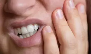 Tooth Decay Occur: దంతక్షయం ఎందుకొస్తుందో తెలుసా..? తీపి కాదు.. ఈ ఆహారాలే ప్రధాన శత్రువులు