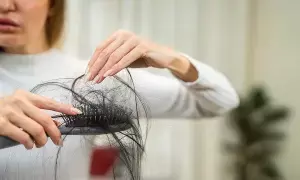 Reduce Hair Fall: ఈ ఆహారాలకు దూరంగా ఉండటం వల్ల జుట్టు రాలడం తగ్గుతుంది.. Reduce Hair Fall: ఈ ఆహారాలకు దూరంగా ఉండటం వల్ల జుట్టు రాలడం తగ్గుతుంది..