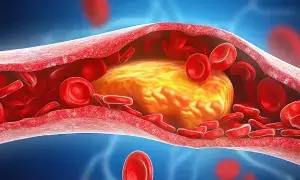 Bad Cholesterol Poses a Threat to the Heart:  గుండెకు గండం చెడు కొలెస్ట్రాల్.. ధమనుల్లో పూడికలు పోవాలంటే ఈ ఆహారాలు తప్పనిసరి!