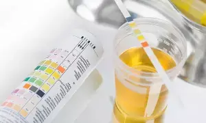 Sign of Prostate Cancer: మగవారి మూత్రంలో ఈ మార్పులు ప్రోస్టేట్ క్యాన్సర్కు సంకేతమా? Sign of Prostate Cancer: మగవారి మూత్రంలో ఈ మార్పులు ప్రోస్టేట్ క్యాన్సర్కు సంకేతమా?