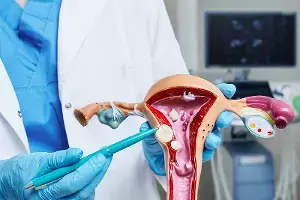 Fibroids in the Uterus: గర్భాశయంలో ఫైబ్రాయిడ్స్ ఉంటే ఏం చేయాలి.?