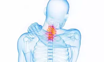 Cervical Spondylosis: మెడ నొప్పిని లైట్ తీసుకుంటున్నారా? అయితే జాగ్రత్త.. అది సర్వైకల్ స్పాండిలోసిస్ కావచ్చు