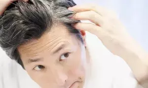 Hair Turns Grey at a Young Age: చిన్న వయసులోనే జుట్టు ఎందుకు తెల్లబడుతుందో తెలుసా.? Hair Turns Grey at a Young Age: చిన్న వయసులోనే జుట్టు ఎందుకు తెల్లబడుతుందో తెలుసా.?