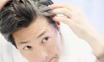 Hair Turns Grey at a Young Age: చిన్న వయసులోనే జుట్టు ఎందుకు తెల్లబడుతుందో తెలుసా.?