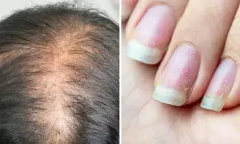 Protein Deficiency in the Body: శరీరంలో ప్రోటీన్ తగ్గుతోందని చెప్పే 6 హెచ్చరికలు.. వీటిని నిర్లక్ష్యం చేయొద్దు..