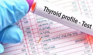 Thyroid Test: థైరాయిడ్ టెస్ట్ ఎప్పుడు చేయించుకోవాలంటే