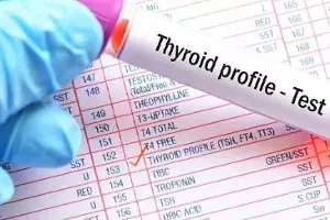 Thyroid Test: థైరాయిడ్ టెస్ట్ ఎప్పుడు చేయించుకోవాలంటే
