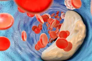 Cholesterol Levels Rise in Winter:  శీతాకాలంలో పెరిగే కొలెస్ట్రాల్: మీ ఆరోగ్యం మీ చేతుల్లోనే..