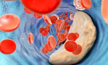 Cholesterol Levels Rise in Winter:  శీతాకాలంలో పెరిగే కొలెస్ట్రాల్: మీ ఆరోగ్యం మీ చేతుల్లోనే..