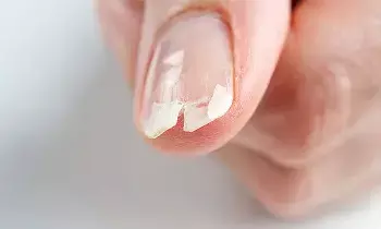 Prevent Your Nails from Breaking: గోర్లు విరిగిపోకుండా ఉండాలంటే ఈ చిట్కాలు ఫాలో కండి