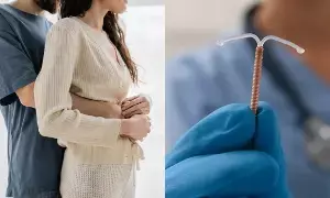 Women Use a Copper-T: మహిళలు కాపర్ టీ వాడితే ఏమవుతుంది? Women Use a Copper-T: మహిళలు కాపర్ టీ వాడితే ఏమవుతుంది?