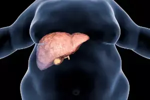 Rising Fatty Liver Risk Among Youth: యువతలో పెరుగుతున్న ఫ్యాటీ లివర్ ముప్పు.. మీరు తినే ఆహారమే శత్రువు కావచ్చు..