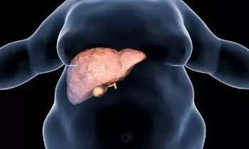 Rising Fatty Liver Risk Among Youth: యువతలో పెరుగుతున్న ఫ్యాటీ లివర్ ముప్పు.. మీరు తినే ఆహారమే శత్రువు కావచ్చు..