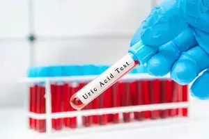 Blood in Urine: మూత్రంలో రక్తం కనిపిస్తోందా? అయితే అది కిడ్నీ క్యాన్సర్ కావచ్చు.. ఎప్పుడు జాగ్రత్తపడాలి? Blood in Urine: మూత్రంలో రక్తం కనిపిస్తోందా? అయితే అది కిడ్నీ క్యాన్సర్ కావచ్చు.. ఎప్పుడు జాగ్రత్తపడాలి?