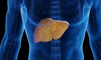 Even Without Alcohol, Liver Can Fail: మద్యం ముట్టకపోయినా లివర్ పని ఖతమ్! తాగని వారిలోనూ పెరుగుతున్న కాలేయ వ్యాధులు..
