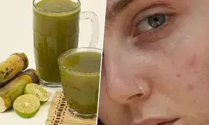 Sugarcane Juice: చెరుకు రసంతో.. మొటిమలకు ఇలా  చెక్ పెట్టండి