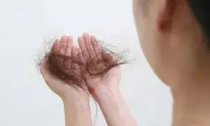 Excessive Hair Fall in Women: మహిళల్లో అధికంగా జుట్టు రాలుతోందా?.. అది ఈ ప్రమాదకర వ్యాధులకు సంకేతం కావచ్చు..