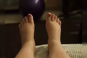 Edema During Pregnancy: ప్రెగ్నెన్సీ టైంలో కాళ్ల వాపు ఎందుకు వస్తదో తెలుసా.?