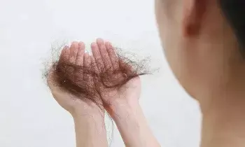 Excessive Hair Fall in Women: మహిళల్లో అధికంగా జుట్టు రాలుతోందా?.. అది ఈ ప్రమాదకర వ్యాధులకు సంకేతం కావచ్చు..