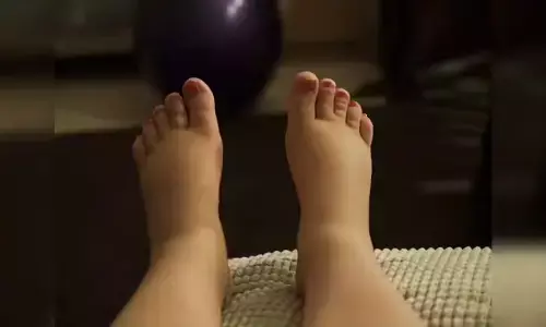 Edema During Pregnancy: ప్రెగ్నెన్సీ టైంలో కాళ్ల వాపు ఎందుకు వస్తదో తెలుసా.? Edema During Pregnancy: ప్రెగ్నెన్సీ టైంలో కాళ్ల వాపు ఎందుకు వస్తదో తెలుసా.?