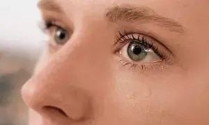 Red Eyes and Watering in Summer: వేసవిలో కళ్లు ఎర్రబడుతున్నాయా? నీరు కారుతోందా? అయితే కావచ్చు..