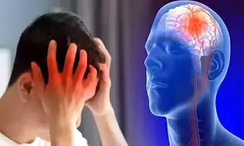 Rising Brain Stroke Cases: యువతలో పెరుగుతున్న బ్రెయిన్ స్ట్రోక్.. ఈ లక్షణాలను అస్సలు నిర్లక్ష్యం చేయకండి..