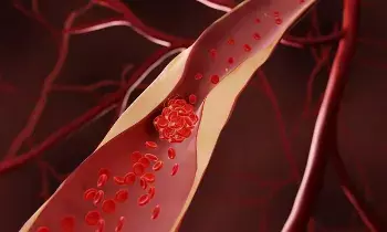 Heart Blockage: గుండెలో అడ్డంకులు ఎందుకు ఏర్పడతాయి..? ఈ లక్షణాలు కనిపిస్తే వెంటనే అలర్ట్ అవ్వండి..